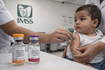 ¿Te vacunaron de bebé? Quiénes SÍ deben vacunarse hoy contra el sarampión 