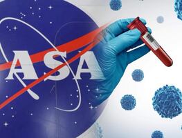 La NASA promueve investigación espacial para combatir el cáncer
