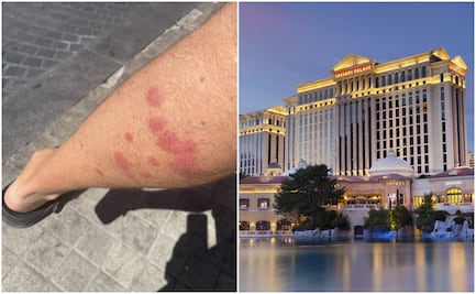 Huéspedes acusan que estos lujosos hoteles en Las Vegas tienen chinches