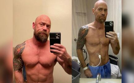 Hombre muestra los estragos que le dejó el coronavirus a su cuerpo 