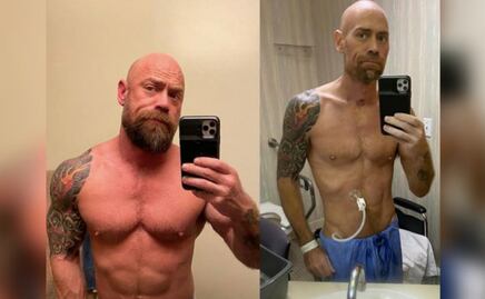 Hombre muestra los estragos que le dejó el coronavirus a su cuerpo