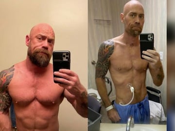 Hombre muestra los estragos que le dejó el coronavirus a su cuerpo