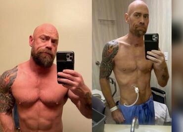 Hombre muestra los estragos que le dejó el coronavirus a su cuerpo