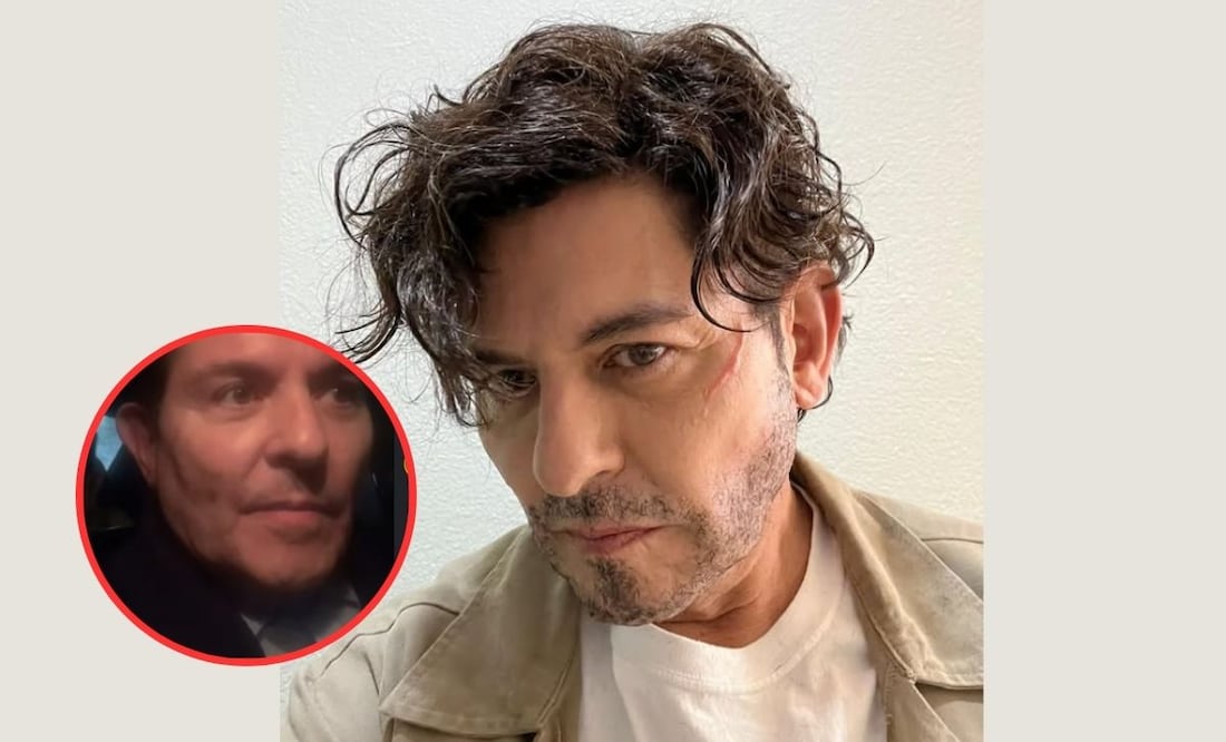 Ernesto Laguardia sufre aparatoso accidente y pide ayuda en redes: "llevo más de 9 horas esperando una patrulla" | Fotos: Instagram @ernestolaguardiaoficial