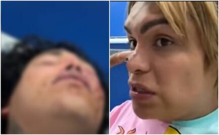 Wendy Guevara quiere trasladar a Paola Suárez a hospital privado tras golpiza de su novio