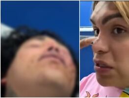 Wendy Guevara quiere trasladar a Paola Suárez a hospital privado tras golpiza de su novio