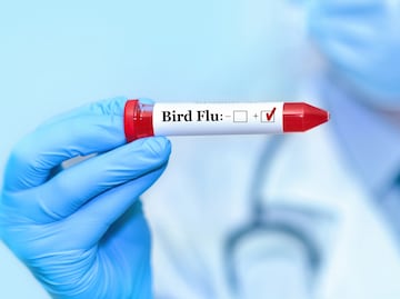 Alerta en Texas: Primer caso de gripe aviar en una persona transmitida por una vaca lechera