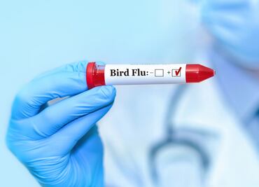 Estados Unidos descarta, por ahora, riesgo de una nueva pandemia por gripe aviar