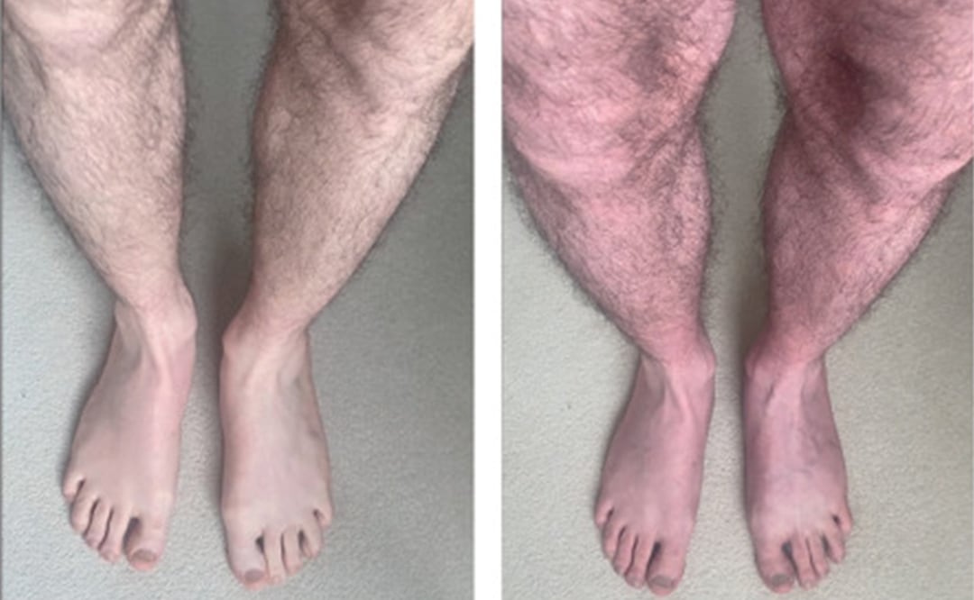 El paciente presentó un cuadro extraño luego de infectarse con Covid-19. Foto: The Lancet