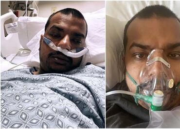 Hombre que se burló de las vacunas muere por Covid-19 en California