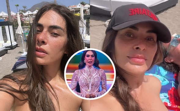 "¿Qué le pasó en el rostro?" Galilea Montijo vuelve a generar preocupación entre sus fans