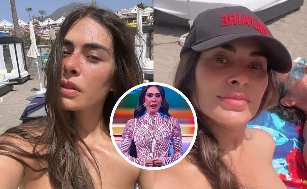"¿Qué le pasó en el rostro?" Galilea Montijo vuelve a generar preocupación entre sus fans. Foto: Instagram / X