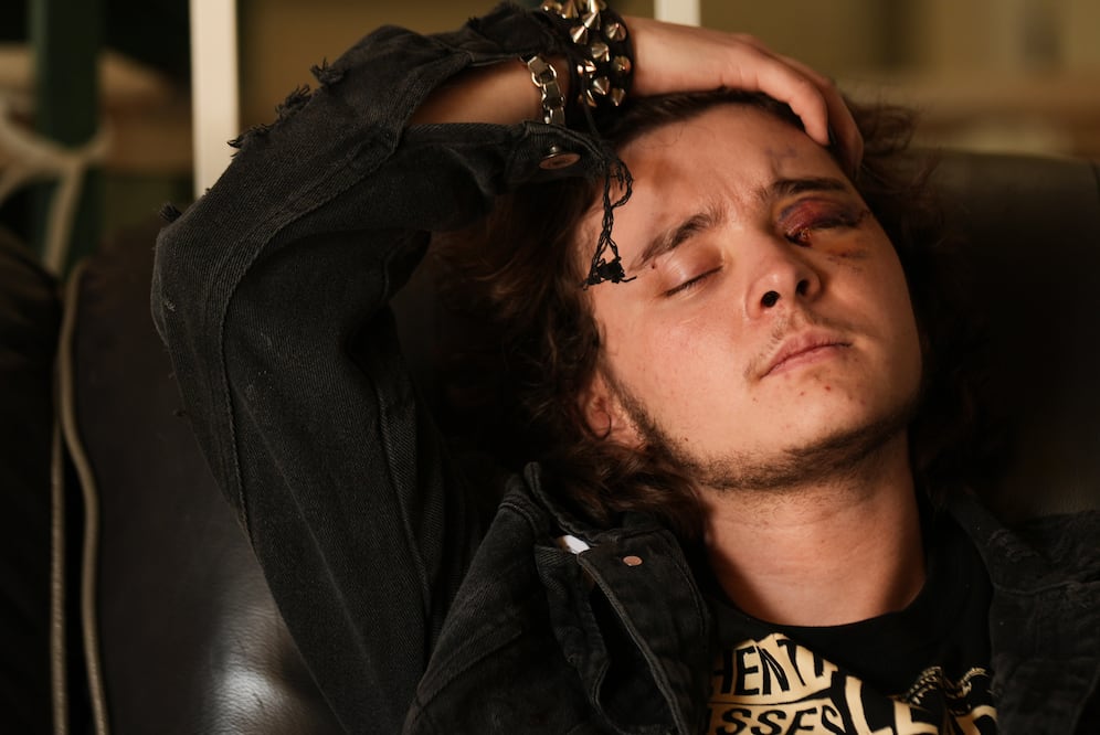 “Temí morir desangrado”: protestas contra ICE dejan a dos jóvenes ciegos de un ojo en California. (AP Photo/Damian Dovarganes)