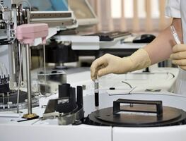 ¿Qué son las pruebas de anticuerpos contra el Covid-19?