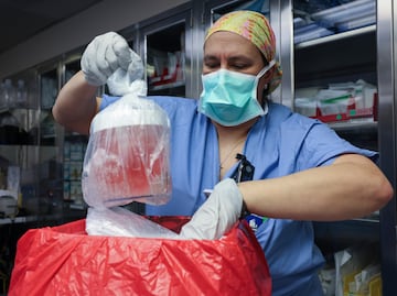 Paciente de 62 años recibe un riñón de cerdo en un innovador trasplante en Boston