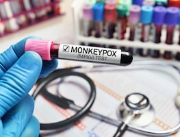 OMS declara nuevamente la viruela del mono como emergencia sanitaria internacional