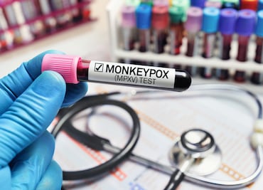 OMS declara nuevamente la viruela del mono como emergencia sanitaria internacional