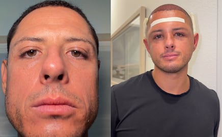 ¿Qué le pasó a Chicharito? Reaparece con el rostro hinchado y sorprende con su nuevo look