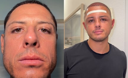 ¿Qué le pasó a Chicharito? Reaparece con el rostro hinchado y sorprende con su nuevo look