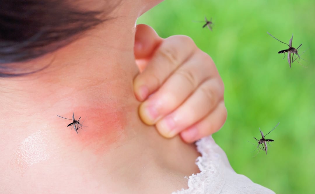 Alertan por la aparición del virus del Nilo Occidental transmitido por mosquitos. ¿Cuáles son los síntomas? Foto: iSTOCK-Kwangmoozaa