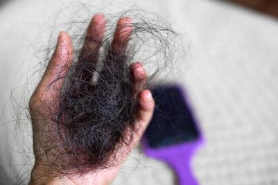 ¿El shampoo morado causa caída de cabello y alopecia? ¿Te ha pasado? Esto opinan los expertos
