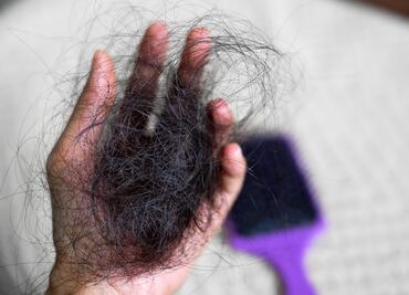 ¿El shampoo morado causa caída de cabello y alopecia? ¿Te ha pasado? Esto opinan los expertos