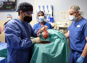 Trasplantan en Estados Unidos el corazón de un cerdo a una persona