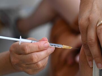 Detectada una primera mujer infectada con viruela del mono en Bélgica