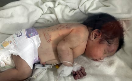  Rescatan a bebé, nacida bajo los escombros al noreste de Siria (video)