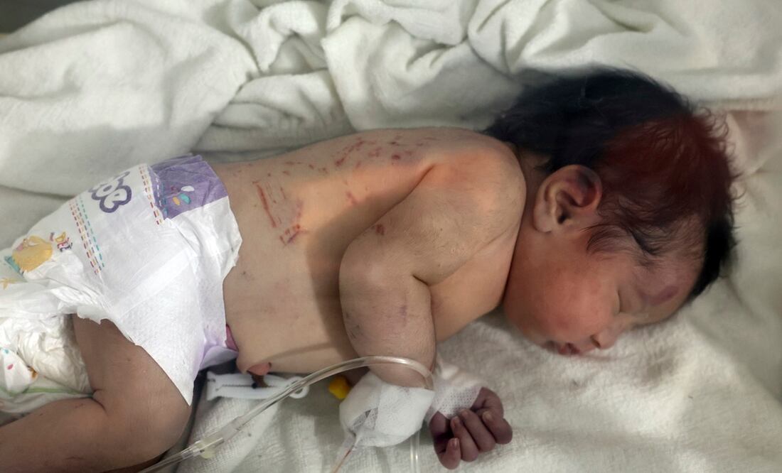 AP Photo/Ghaith Alsayed