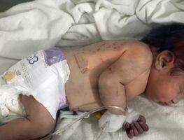 Rescatan a bebé, nacida bajo los escombros al noreste de Siria (video)