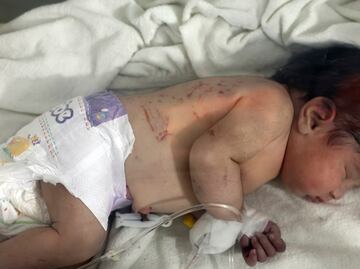 Rescatan a bebé, nacida bajo los escombros al noreste de Siria (video)