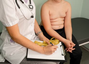 La obesidad se ha cuadruplicado en niños y adolescentes desde 1990: OMS