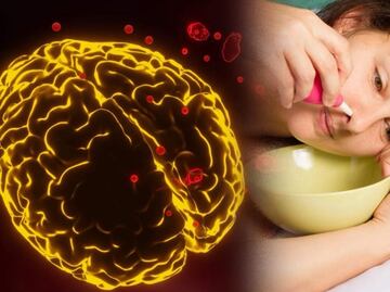 Mueren tres personas por ameba “come cerebros”; se infectaron con agua de la llave