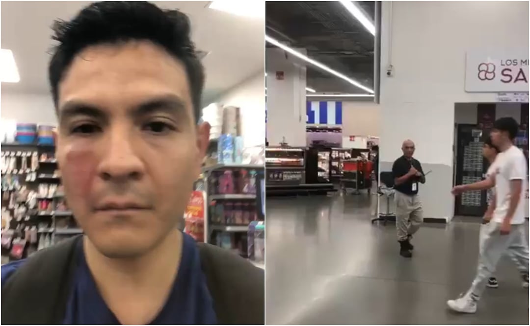 Agresión en Walmart: hombre acusa a guardia de seguridad de golpearlo en la cara; "Vean como me dejó, nadie me ayudó". Foto: X/ Alberto Tavira