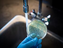 La OMS alerta de un resurgimiento de los casos globales de cólera; ¿Qué es y cómo se contagia?