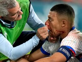 Mbappé fracturado: El impactante choque que lo deja fuera del partido Austria-Francia en la Eurocopa