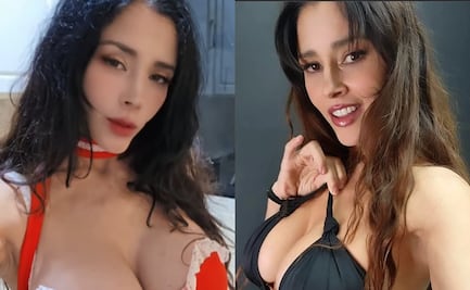 Así luce hoy Dorismar tras una cirugía estética que salió mal: “estoy en rehabilitación”