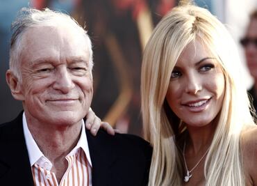 Viuda de Hugh Hefner perdió miles de seguidores por revertir cirugía estética