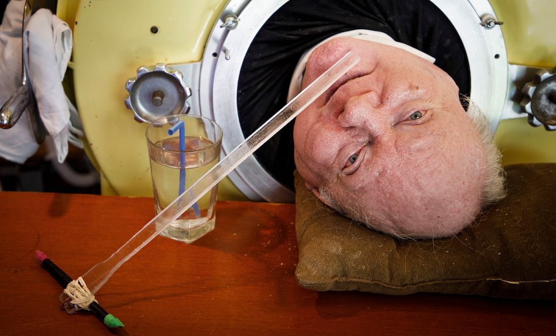 Muere Paul Alexander, quien desafió la polio en un "pulmón de hierro" durante siete décadas (Smiley N. Pool/The Dallas Morning News via AP)