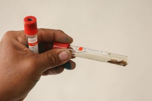 Gusano barrenador en EU: autoridades reportan primer paciente diagnosticado en el país