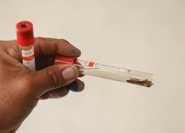 Gusano barrenador en EU: autoridades reportan primer paciente diagnosticado en el país