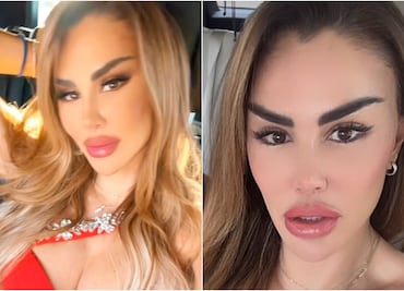 ¿Qué se hizo? Critican a Ninel Conde por lucir irreconocible tras múltiples cirugías plásticas