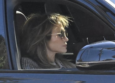 ¿Jennifer Lopez ya olvidó a Ben Affleck? Se somete a operación y cambio de look