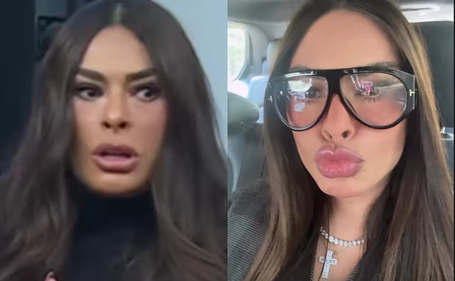 “¡Avísenme!” Galilea Montijo rompe el silencio sobre su rostro hinchado que desató polémica