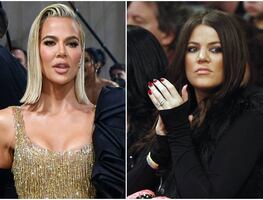 “Sólo me hice la nariz”; Khloé Kardashian niega haberse sometido a varias cirugías