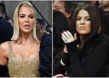“Sólo me hice la nariz”; Khloé Kardashian niega haberse sometido a varias cirugías