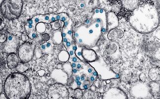 Coronavirus: Identifican en EU un caso de la variante 'doble mutante' 