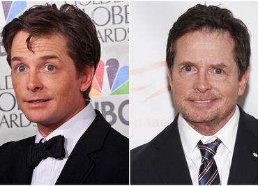 Parkinson; la lucha de vida de Michael J. Fox, la estrella de 'Volver al Futuro'