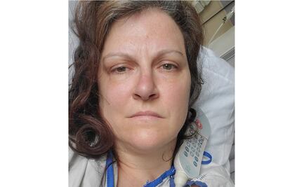 Mujer sufre dos derrames cerebrales tras pensar que se había recuperado de coronavirus